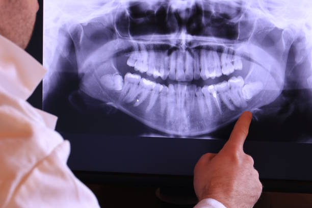 Best Emergency Treatment for Toothache in Woodbury Center, CT